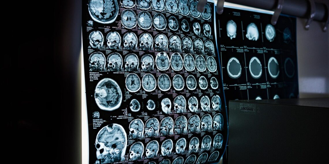 what is the value of x